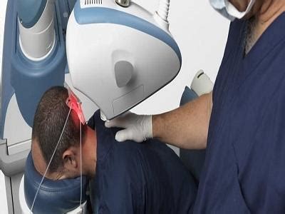 Robotic Hair Transplant Market to See Sustainable Growth Ahead