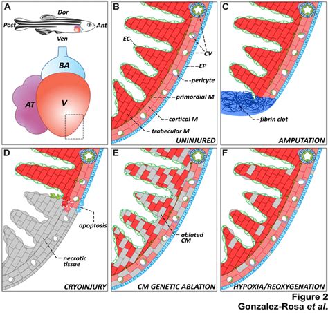 The zebrafish heart: anatomy, histology and injury paradigms. (A ...