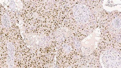 p21 (WAF1 Protein) - IHC Primary Antibodies