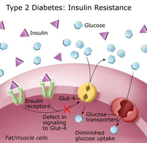 What Is Type 2 Diabetes Mellitus Or Non Insulin Depen - vrogue.co