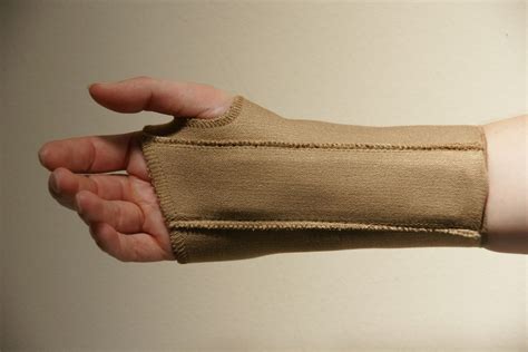 Splinting | Carpal-Tunnel.net