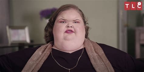 1000-lb Sisters' Tammy Slaton undergoes major life-saving surgery to lose more weight as she ...