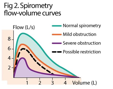 Spirometry Types