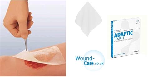 Wound Care: Wound Dressings-The Healing Expert