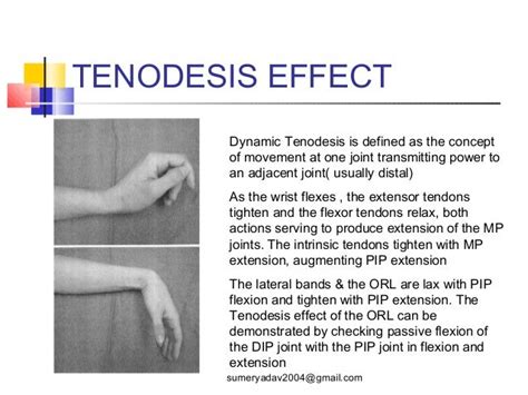 extensor tendons injury and deformity