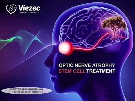 What is Optic Nerve Atrophy, Its Symptoms, Causes, Tests, and Diagnosis? | by Viezec Stem Cell ...