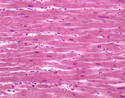 anatomyforme: Muscle Tissue Histology