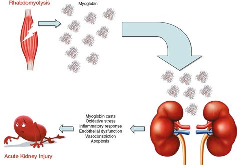 Serum myoglobin immunoassays: obsolete or still clinically useful?