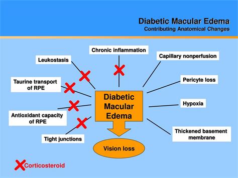 PPT - Diabetic Macular Edema 2010 PowerPoint Presentation - ID:641843