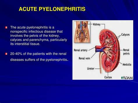 [DIAGRAM] Diagram Of Pyelonephritis - MYDIAGRAM.ONLINE