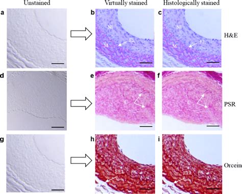 Virtual staining results versus the H&E-, PSR-, and orcein-stained... | Download Scientific Diagram