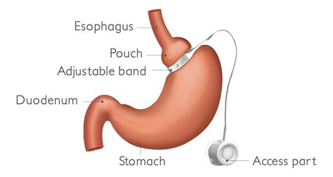 chirurgie esthétique plastique