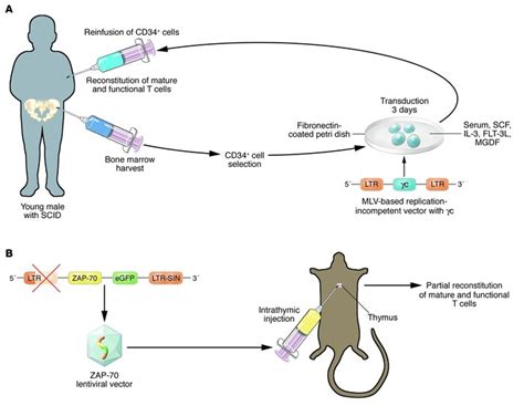 JCI - A new direction for gene therapy: intrathymic T cell–specific ...