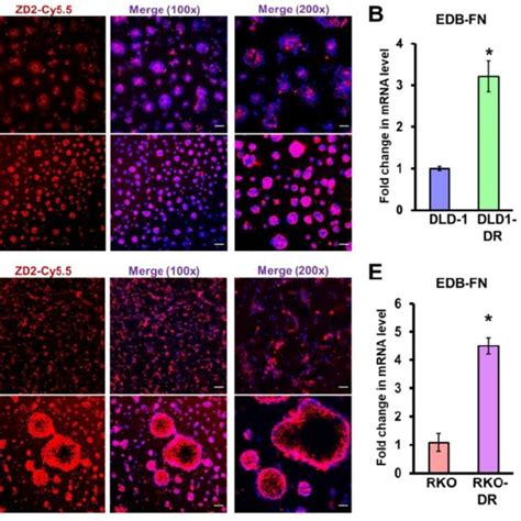 Acquired drug resistance is associated with EDB-FN expression in CRC... | Download Scientific ...