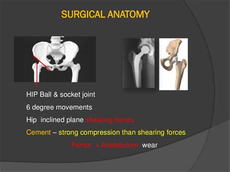 Hip arthroplasty surgical anatomy and approaches