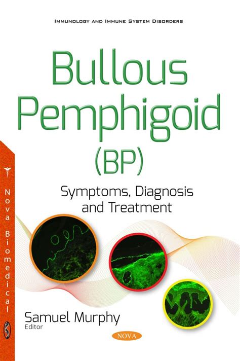 Bullous Pemphigoid (BP): Symptoms, Diagnosis and Treatment – Nova ...