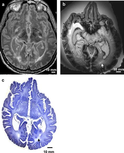 Panel of 3 Tesla MRI versus 7 Tesla MRI: this panel includes a... | Download Scientific Diagram