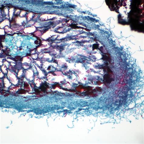 Ectotrophic Mycorrhiza, c.s., 12 µm Microscope Slide | Carolina Biological Supply