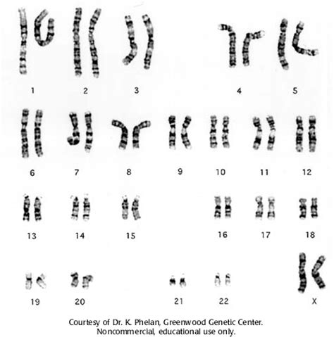 Human female karyotype :: CSHL DNA Learning Center