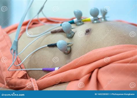 Electrocardiogram. stock photo. Image of exam, closeup - 165228302