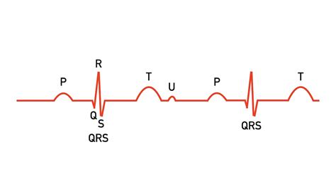 ECG Waveform Explained: EKG Labeled Diagrams and Components — EZmed