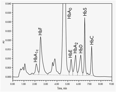 Hemoglobin Variants - HPLC