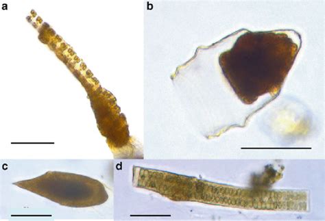 4 Examples of heterotrophic protist morphotypes observed in western ...