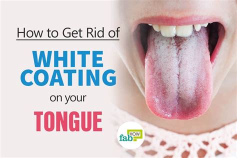 Did you wake up today and find something funky on your tongue? If it appears coated with a white ...