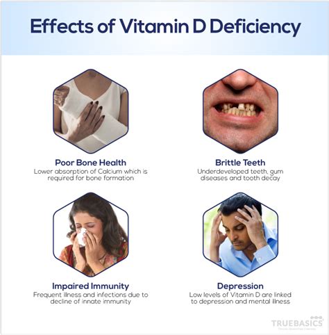 Vitamin D Deficiency: Symptoms, Roles and Sources