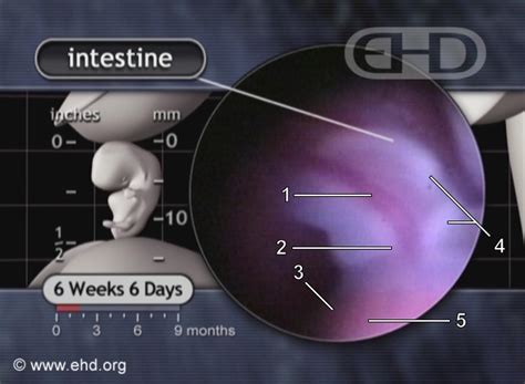 The Umbilical Cord