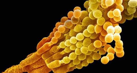 Penicillium notatum showing conidiophores and conidia - Dr Fred Hossler/Getty Images © | Peapix