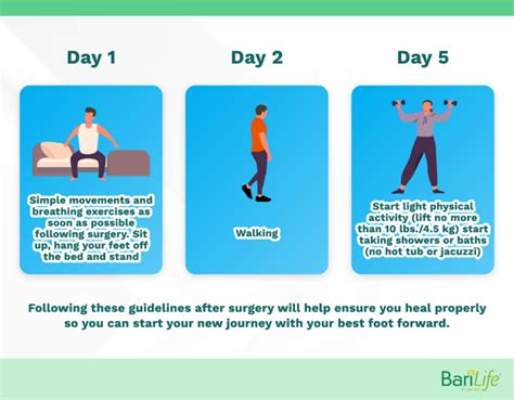 Gastric Sleeve Recovery: The Ultimate Guide - From Bari Life