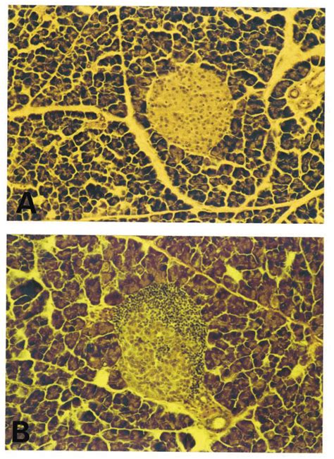 A, B. Representative histology of pancreatic sections prepared from ...