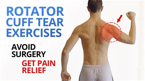 Rotator Cuff Tear Exercises | Porn Sex Picture