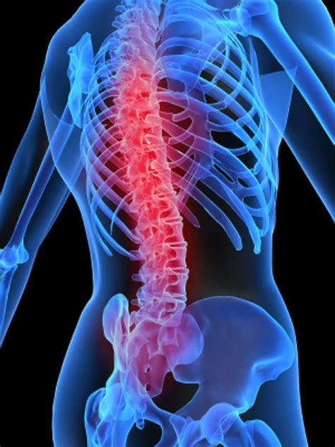 treatment of diseases: Spinal stenosis of the lumbar spine: Causes