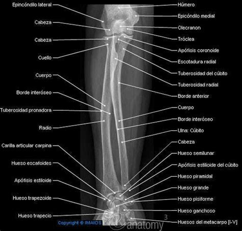 Radiography - Antebrazo : Radio, Ulna: Cúbito, Cabeza, Tuberosidad del ...