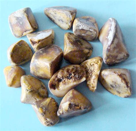 File:Gallstones1pl.jpg - Wikimedia Commons