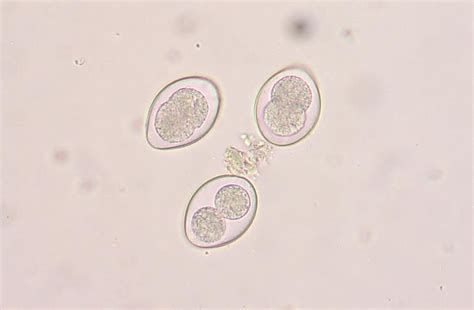 Microscope World Blog: Parasites in Sheep & Goats