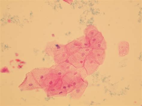 Microscopic Analysis of Urine | Faculty of Medicine, Masaryk University