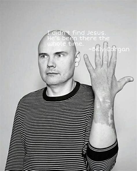 Billy Corgan Hand Birthmark