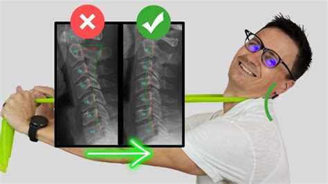 Best Exercise to Fix Loss of Neck Curve (cervical lordosis) or Military ...