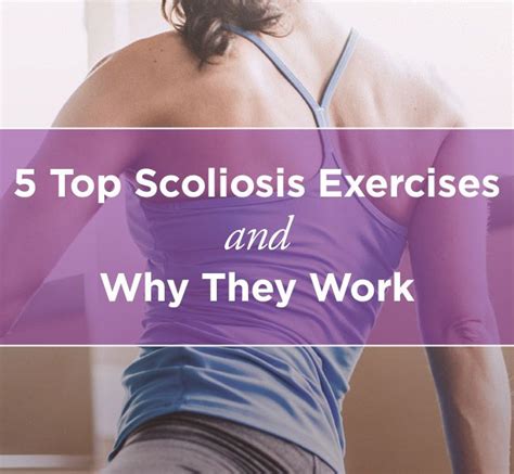 Scoliosis exercises my 5 favourite exercises for scoliosis – Artofit