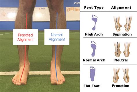 Corrective Exercise for foot and ankle | Knee tendonitis, Exercise ...