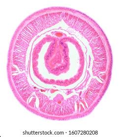 Cross Section Planarian Under Microscope Planaria Stock Photo ...