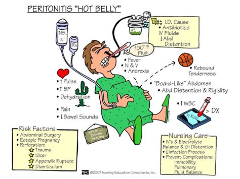 Peritonitis – ONESTOPNURSING | Medical surgical nursing, Nursing mnemonics, Surgical nursing