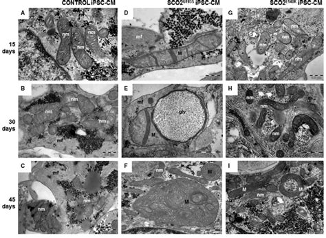 TEM images showing mitochondria from 15-, 30-and 45-day-old control ...