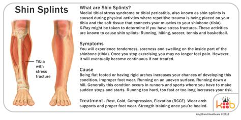 What are Shin Splints? | Shin splints, Shin splints treatment, Medial tibial stress syndrome