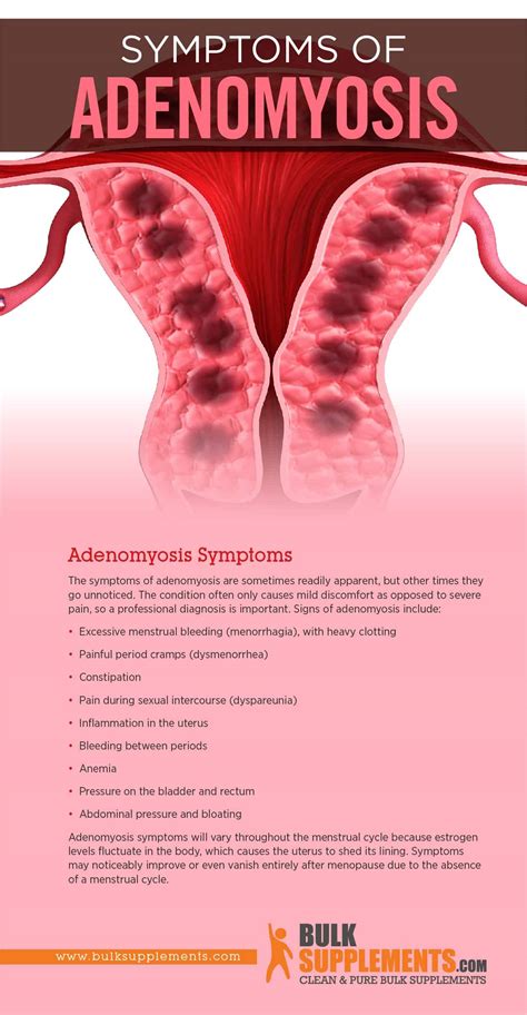 Tablo | Read 'Adenomyosis: Causes, Symptoms & Treatment' by