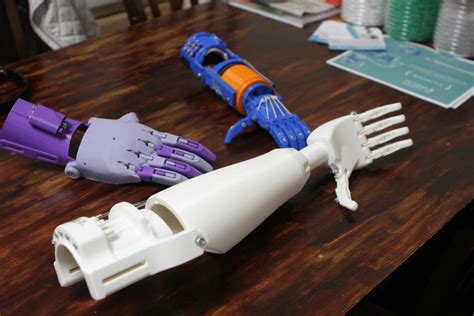 3d Printed Artificial Limbs - Get More Anythink's