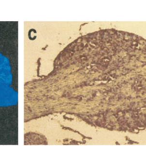 Northern blot and in situ hybridization. a, Northern blot with 4 g of... | Download Scientific ...